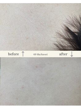 オフオルファヴォリ(OF Olu:Favori)/【フラッシュワックス脱毛】