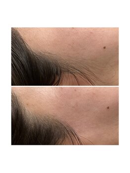 ホワイトワックス 京都四条烏丸(WHITE WAX)/《全顔》フェイシャルワックス