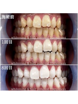 ハピネス 心斎橋アメリカ村本店(Happiness)/1番人気