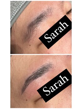 サラ(Sarah)/メンズハリウッドブロウリフト