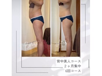 レムロード 赤羽店/お腹や背中がスッキリ!!