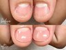 【深爪育成】大満足しっかり甘皮ケア＆“爪育成”深爪長さ出し120分¥19,980