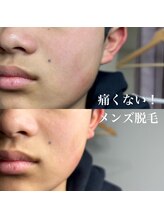 デイジー アイラッシュ(daisy)/都度払いのメンズ脱毛