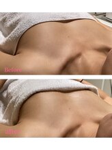 セレーネボーテプラス/