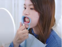 ルカノン(le canon)/マウスオープナーの装着