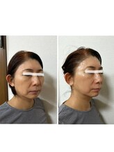 モモラ(Spa MoMora)/この変化を貴方に！港区白金台