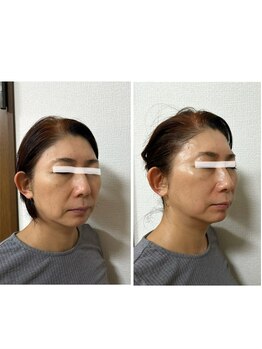 モモラ(Spa MoMora)/この変化を貴方に！港区白金台