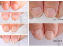 深爪さん多数来店◎ネイルNGな職場の方に人気の地爪風仕上げあり