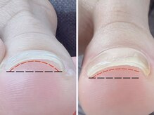 ミネイル(me.nail)