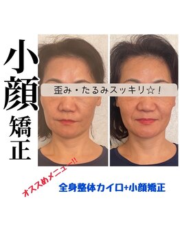 カイロプラクテックサロンドアール(Salon de R)/顔の歪み&タルミ改善♪