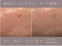 アールエスト(R EST.)の雰囲気(ハーブピーリングのベテランが毛穴、シワ、ニキビ、跡などを改善)