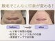 ケイ(Kei)の写真