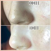 エクレ 下北沢店(ecle)