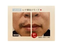 ラー アクア(La akua)の雰囲気（新搭載の爆抜けモード）