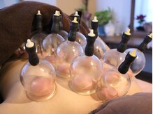 あめのちはれの雰囲気（病みつきになる吸玉で心や体の不要なものを吸い上げます☆）