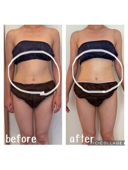 ヨサパーク ピクシス(YOSA PARK)/お腹周りスッキリ☆