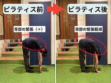 ファクト(fact)/長時間の立ち仕事による腰痛