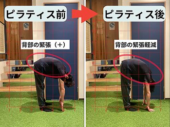 ファクト(fact)/長時間の立ち仕事による腰痛