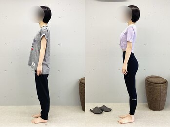 イレ 名古屋栄(ile)/長年の猫背が5回でここまで変化