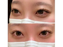 ビー(Be)/束感が可愛い！
