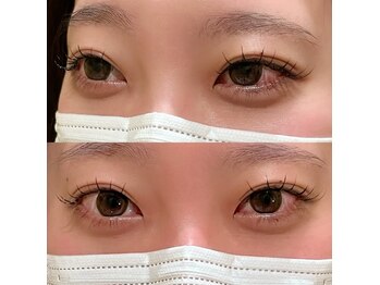 ビー(Be)/束感が可愛い！