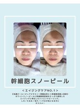 ソワナ(soina)/【神楽坂駅/フェイシャル/毛穴】