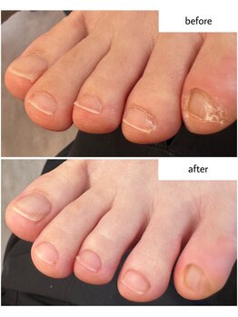 ケアプラス(care plus)/フットネイルケア