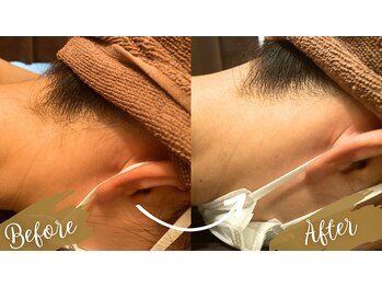 チャンティック(Cantik)/うなじケア