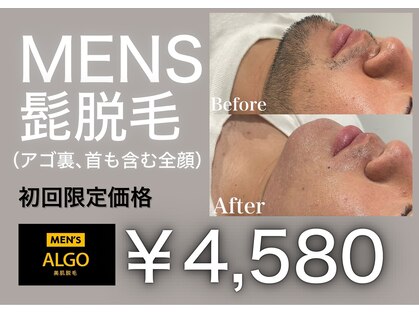 アルゴ 伊勢崎店(ALGO)の写真