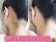 エースター(A-star)の写真