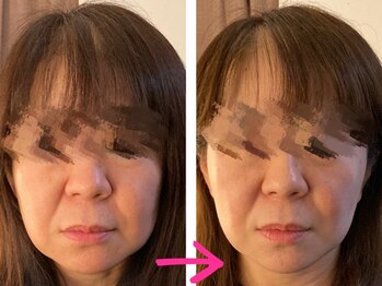 テールボーテ(Terre beaute)/輪郭の変化を実感