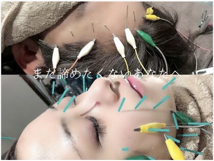 セントラル鍼灸院リラクシー(Re:laxy)の写真