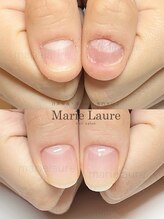 マリーロール 淀屋橋本店(Marie Laure)/自爪育成/深爪矯正/ネイルケア
