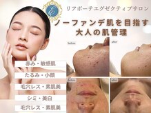 エマーチェ 自由が丘(emmace)