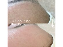 リベルキョウト 京都駅前店(Liber Kyoto)/フェイスワックス脱毛