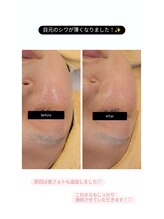 クレール 小山店(CLAIR)/【美肌フォト+エレポレ】