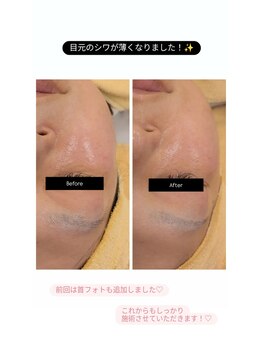 クレール 小山店(CLAIR)/【美肌フォト+エレポレ】