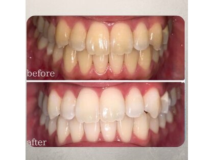 ホワイトニング ビューティー 山梨の写真