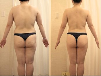 ファニービー 吹田店/3ヶ月でマイナス13kg達成！