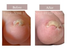 ハギネイル 吉川(Hagi_Nail)の雰囲気（巻きが強い、親指以外の小さな爪も対応可能◎）