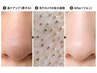 【迷ったらこれ】毛穴カメラ診断で最適提案★黒ずみ開き詰まり対応