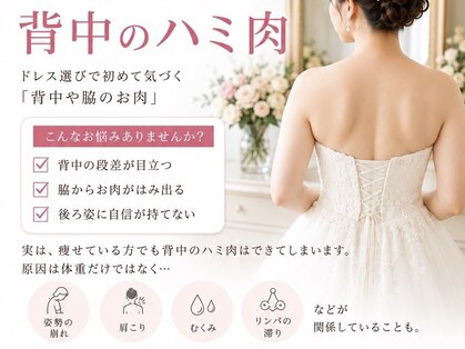 プラディンケリエの写真