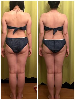 ヨサ パーク コアハート(YOSA PARK CORE HEART)/