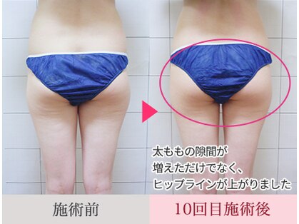 ビューティ ケア ルーム メロウ(Beauty Care Room Moelleux)の写真