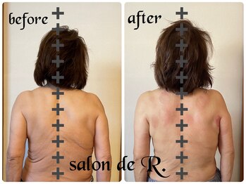 サロン ド アール(salon de R.)/【お背中骨氣・70代・施術効果】