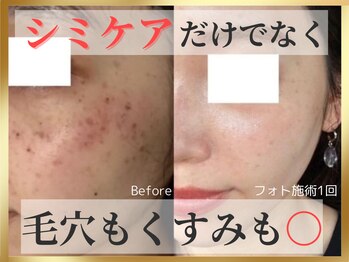 シャイン アイラッシュ(Shine Eyelash)