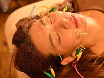 ジーニー(genie)の写真/美容鍼×ヘッドスパで小顔効果◎美容鍼だからできるアプローチでスッキリフェイスラインへ♪たるみケアにも