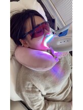 ペルラメディカルホワイトニング 名古屋/結果保証・返金保証