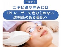 スリリアン 銀座の雰囲気（【気になる赤みまで徹底美肌】色むらのない透明感に仕上げます。）