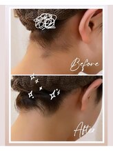 グラント(grant)/【全身脱毛】うなじ